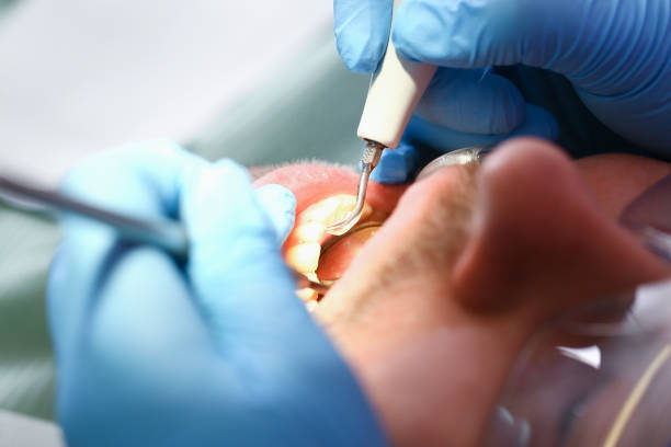 Best Emergency Dental Services for Seniors in Vidor, TX